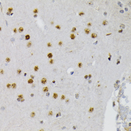 Phospho-CREB1-S133 Rabbit Polyclonal Antibody - Image 2