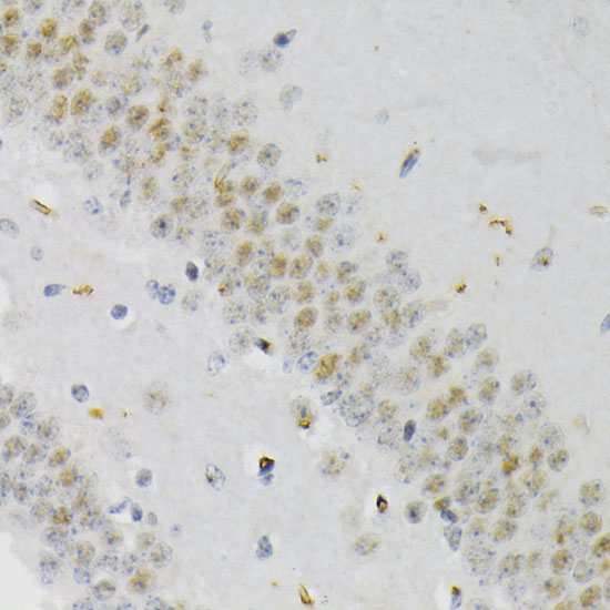 Phospho-CREB1-S133 Rabbit Polyclonal Antibody - Image 4