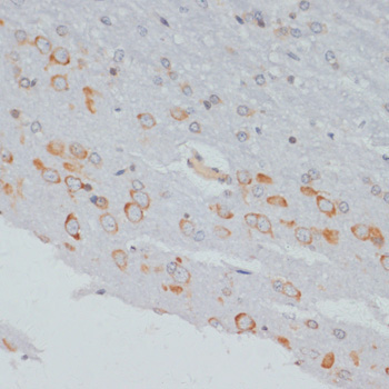 Phospho-CRKL-Y207 Rabbit Polyclonal Antibody - Image 2