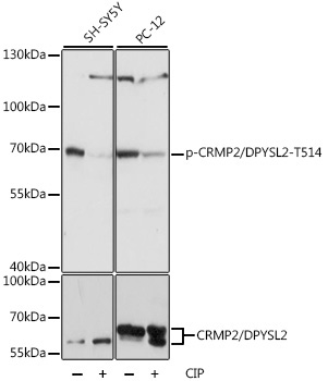 Phospho-CRMP2/DPYSL2-T514 Rabbit Polyclonal Antibody