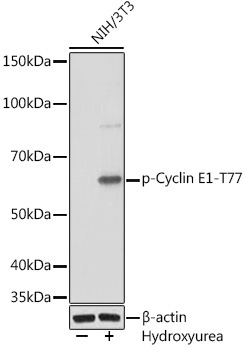 Phospho-Cyclin E1-T77 Rabbit Monoclonal Antibody