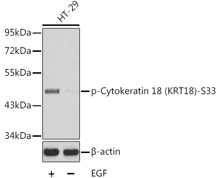 Phospho-Cytokeratin 18 (KRT18)-S33 Rabbit Polyclonal Antibody