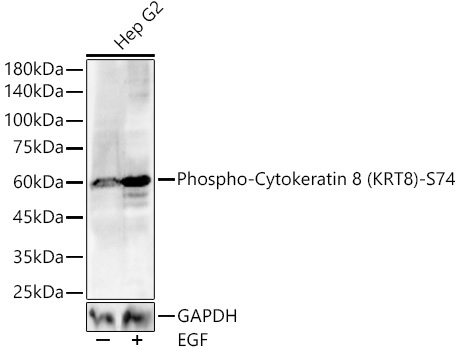 Phospho-Cytokeratin 8 (KRT8)-S74 Rabbit Polyclonal Antibody