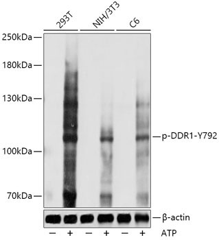 Phospho-DDR1-Y792 Rabbit Polyclonal Antibody