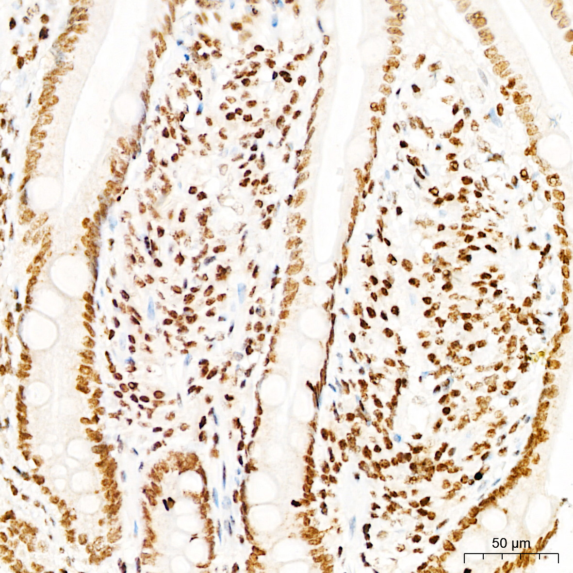 Phospho-DNA-PKcs-S2056 Rabbit Polyclonal Antibody - Image 2