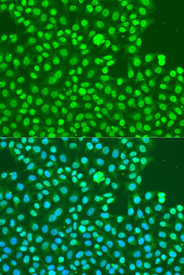 Phospho-DNA-PKcs-S2056 Rabbit Polyclonal Antibody - Image 3