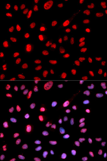 Phospho-DNMT1-S714 Rabbit Polyclonal Antibody