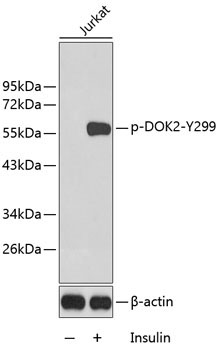 Phospho-DOK2-Y299 Rabbit Polyclonal Antibody
