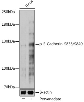 Phospho-E-Cadherin-S838/S840 Rabbit Polyclonal Antibody