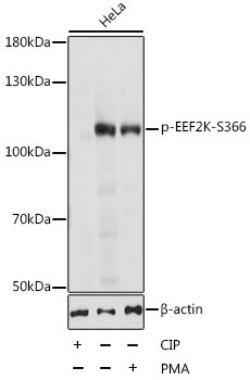 Phospho-EEF2K-S366 Rabbit Polyclonal Antibody