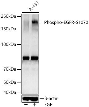 Phospho-EGFR-S1070 Rabbit Polyclonal Antibody
