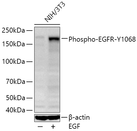 Phospho-EGFR-Y1068 Rabbit Monoclonal Antibody
