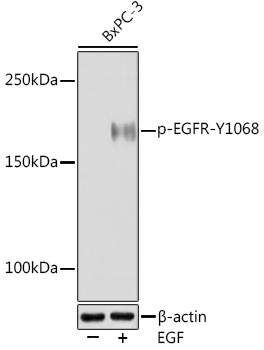 Phospho-EGFR-Y1068 Rabbit Monoclonal Antibody