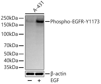 Phospho-EGFR-Y1173 Rabbit Monoclonal Antibody