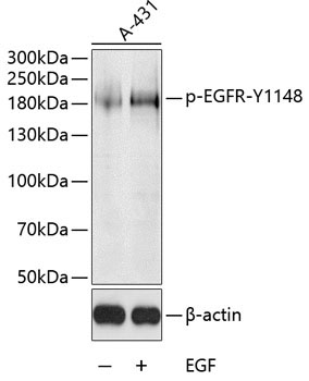 Phospho-EGFR-Y126,600 Rabbit Polyclonal Antibody