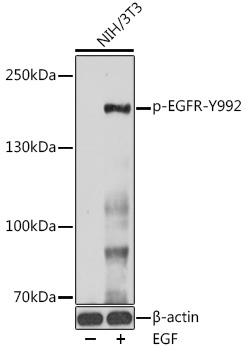 Phospho-EGFR-Y992 Rabbit Polyclonal Antibody - Image 2
