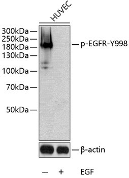 Phospho-EGFR-Y998 Rabbit Polyclonal Antibody