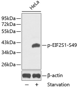 Phospho-eIF2Alpha-S49 Rabbit Polyclonal Antibody