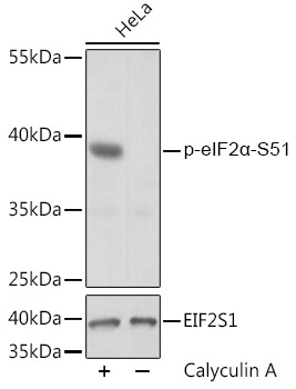 Phospho-eIF2Alpha-S51 Rabbit Polyclonal Antibody