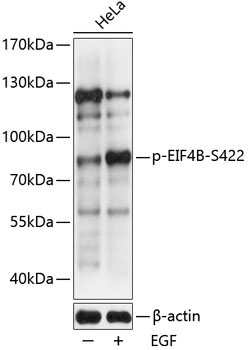 Phospho-EIF4B-S422 Rabbit Polyclonal Antibody