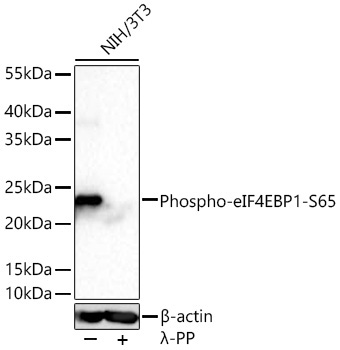 Phospho-eIF4EBP1-S65 Rabbit Monoclonal Antibody