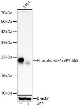 Phospho-eIF4EBP1-S65 Rabbit Polyclonal Antibody