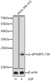 Phospho-eIF4EBP1-T36 Rabbit Polyclonal Antibody