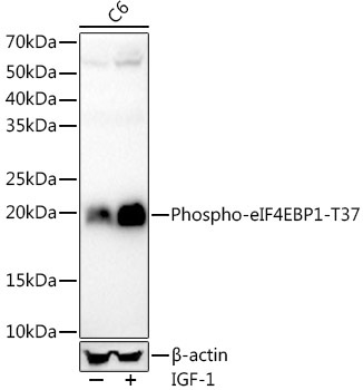 Phospho-eIF4EBP1-T37 Rabbit Monoclonal Antibody