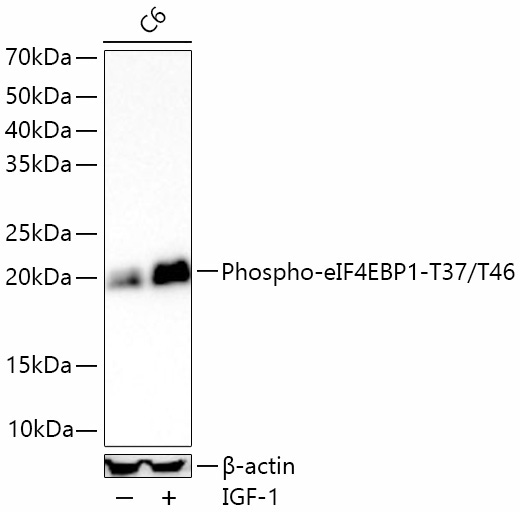 Phospho-eIF4EBP1-T37/T46 Rabbit Monoclonal Antibody
