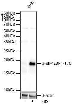 Phospho-eIF4EBP1-T70 Rabbit Monoclonal Antibody