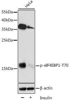 Phospho-eIF4EBP1-T70 Rabbit Polyclonal Antibody