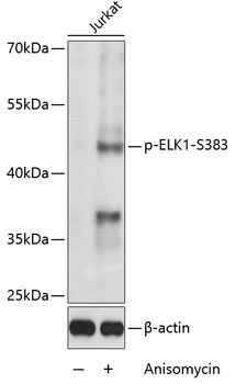 Phospho-ELK1-S383 Rabbit Polyclonal Antibody