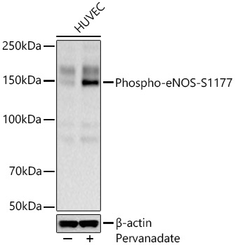 Phospho-eNOS-S1177 Rabbit Monoclonal Antibody