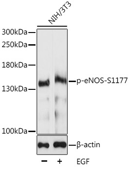 Phospho-eNOS-S1177 Rabbit Polyclonal Antibody