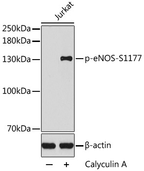 Phospho-eNOS-S1177 Rabbit Polyclonal Antibody