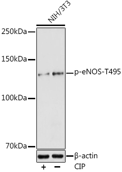 Phospho-eNOS-T495 Rabbit Polyclonal Antibody