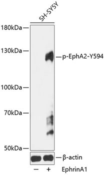 Phospho-EPHA2-Y594 Rabbit Polyclonal Antibody
