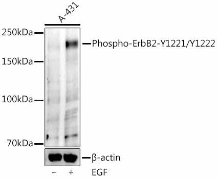Phospho-ErbB2-Y1221/Y1222 Rabbit Monoclonal Antibody