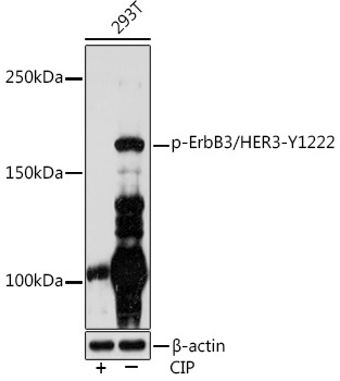 Phospho-ErbB3/HER3-Y1222 Rabbit Monoclonal Antibody