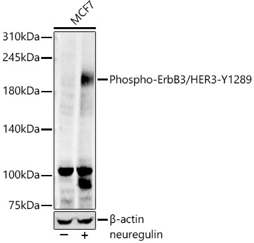 Phospho-ErbB3/HER3-Y1289 Rabbit Monoclonal Antibody