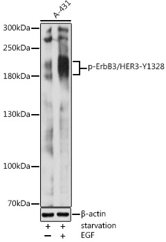 Phospho-ErbB3/HER3-Y1328 Rabbit Polyclonal Antibody