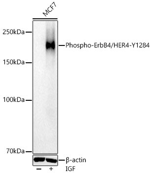 Phospho-ErbB4/HER4-Y1284 Rabbit Polyclonal Antibody