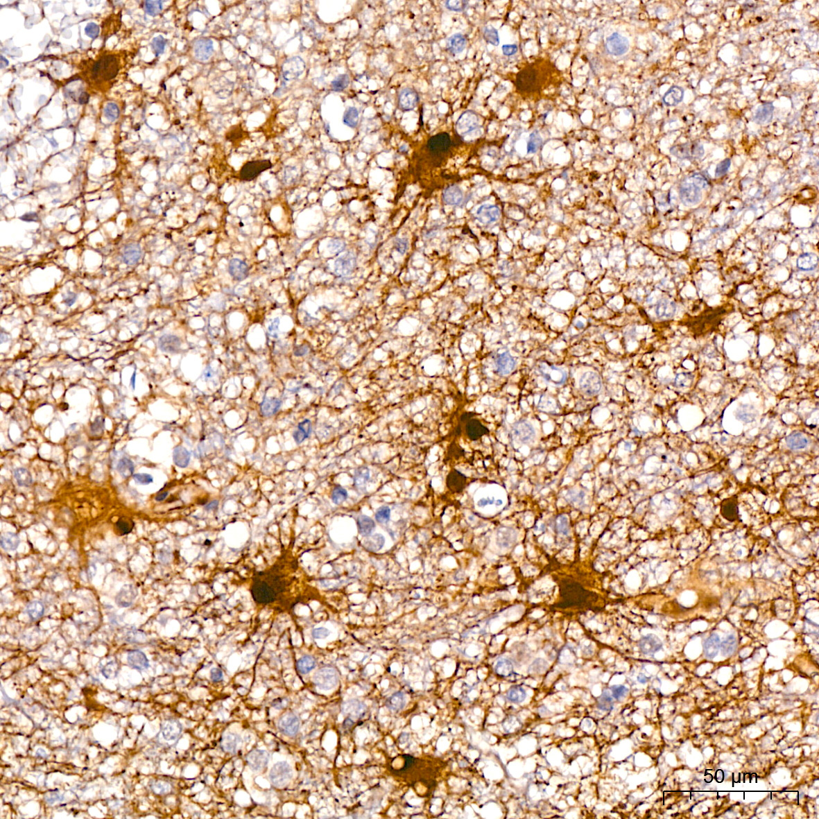 Phospho-ERK1-T202 + ERK2-T185 Rabbit Monoclonal Antibody - Image 3