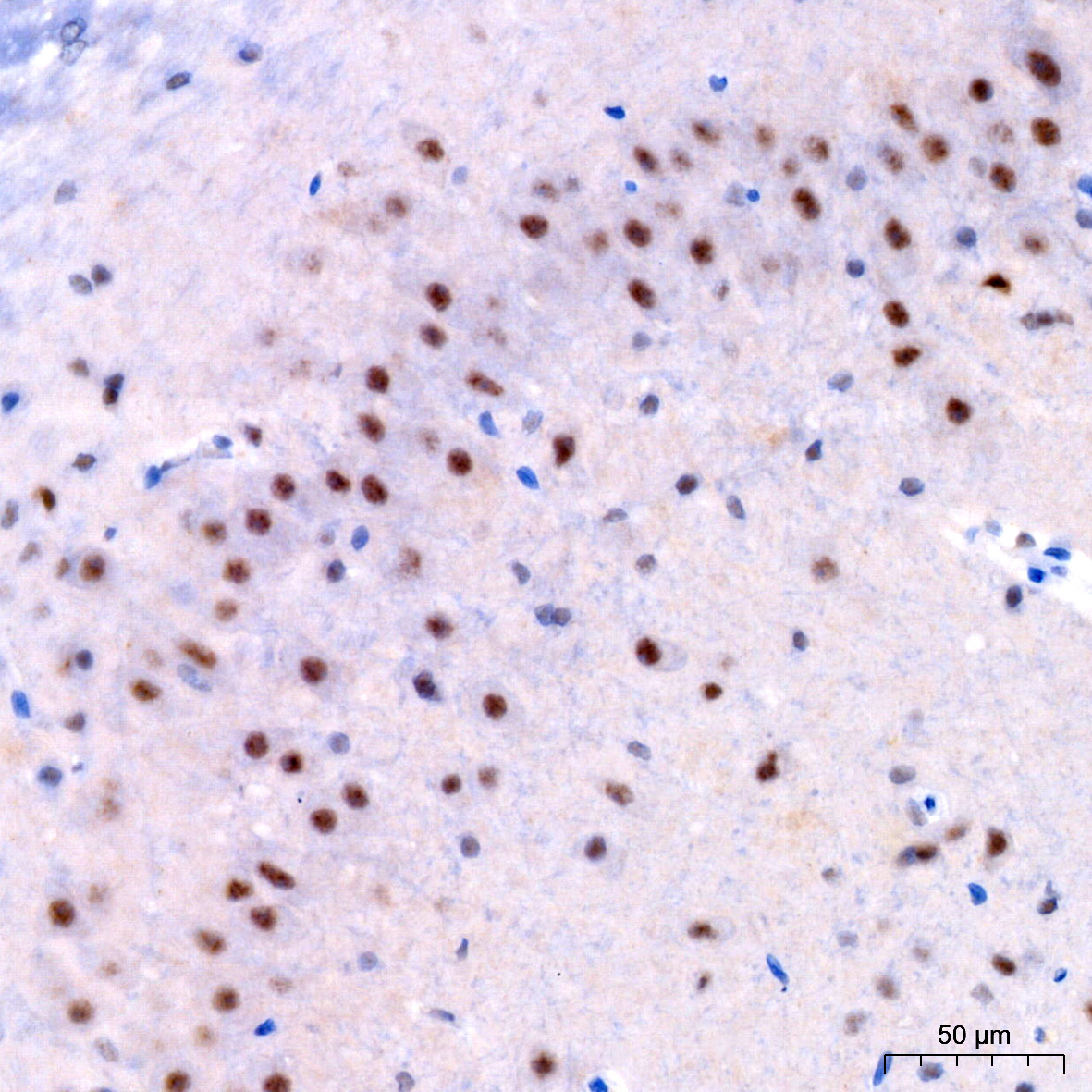 Phospho-ERK1-T202 + ERK2-T185 Rabbit Monoclonal Antibody - Image 4