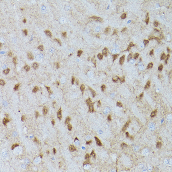 Phospho-ERK1-T202/Y204 + ERK2-T185/Y187 Rabbit Monoclonal Antibody - Image 3