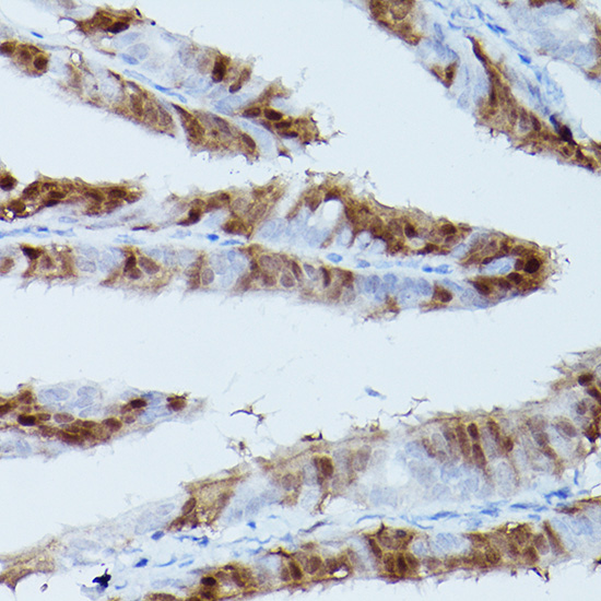 Phospho-ERK1-T202/Y204 + ERK2-T185/Y187 Rabbit Monoclonal Antibody - Image 4