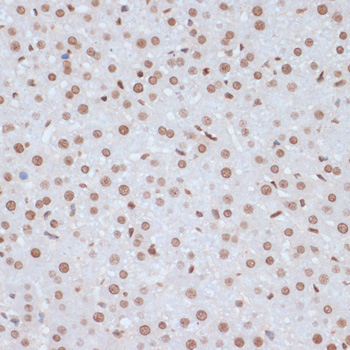 Phospho-ERK1-Y204 + ERK2-Y187 Rabbit Polyclonal Antibody - Image 2