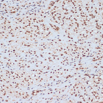 Phospho-ERK1-Y204 + ERK2-Y187 Rabbit Polyclonal Antibody - Image 3