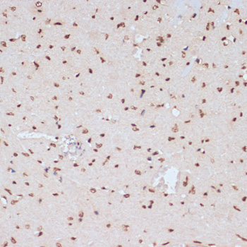 Phospho-ERK1-Y204 + ERK2-Y187 Rabbit Polyclonal Antibody - Image 4