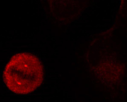 Phospho-ERK1-Y204 + ERK2-Y187 Rabbit Polyclonal Antibody - Image 5
